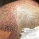 This is how your frontal/temporal area will look