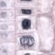 The upper-centre cell is in interphase (nucleus still visible); the lower cell is in late metaphase/early anaphase