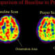Scans of Franciscan nuns in prayer, shows activity in the superior parietal lobe, where the brain's responsibility is for orientation. Activity decreases significantly during prayer as per Newberg’s study.