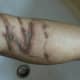 box jelly fish stings as hell...