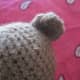 Sewn on ear
