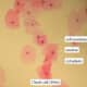 Cheek cells under a microscope magnified 400x