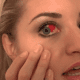 burst-blood-vessel-in-eye-symptoms-causes-treatment