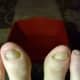 April 20, 2014. The bottom part of the nails on my big toes are starting to look normal and the rest of the nails are starting to turn clear.