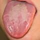 Geographic Tongue WikiMedia/Commons/ageekgal