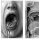 Max Brodel from Johns Hopkins is a master of medical illustration.