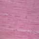 Smooth Muscle H&E Stain