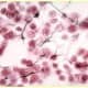 Reticular Connective Tissue H&E Stain with Silver Impregnation
