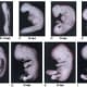 Stages of the Human baby...certainly metamorphism at it's most profound
