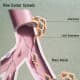 Metastasis  or how cancer spreads from one organ or part to another distant organ or part.  
