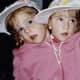 Abby and Brittany as toddlers