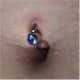 Scar on top hole and keloid on the bottom hole.