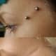 dermal-piercing-types-pictures-procedure-after-care-and-risks