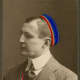 dueling-scars-the-badge-of-honor-of-many-nazi-officers