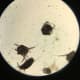 These are ear mites. Pets that have a particularly bad infestation, you can see the ear wax moving with an otoscope. 