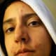 what-does-herpes-look-like-does-herpes-look-like-a-pimple