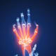 Hand and wrist joint pain is also common in Lupus patients.