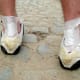 Blisters resulting from shoes may or may not be related to diabetes. If they are large or occur often and heal slowly, call your doctor.