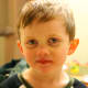 The author's 5 year old son, 4 days after his revision supraglottoplasty. Feeling tired and weak, but improving every day.