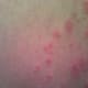 Here it is hanging out on my right thigh