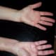 I hope my right hand will eventually look as slim as my left hand! :(