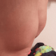 Fluid on the front of my knee