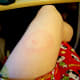 My second Lyme disease rash, in 2010. This rash was much larger and spread out. The bite was on my head, but as you can see in this photo, the rash was on my leg.