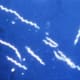 Photomicrograph of Burrelia burgdorferi, the spirochete that causes Lyme disease.