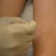 what-is-molluscum-contagiosum-and-how-to-treat-it