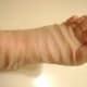 Wrinkled Skin Working Hard to Heal