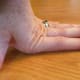 Hypermobile finger joints