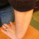Turning my wrist around at least 90 deg. - hypermobile shoulder