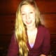 March 2011: Braces on (just can't see them in this picture) and five months before surgery.