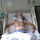 esophagus-cancer