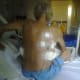 esophagus-cancer