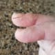 My splitting fingers.