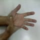 Some ways in which acupressure is applied