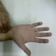 Some ways in which acupressure is applied