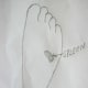 figure 11 A, point for spleen in left foot only