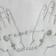 figure 12 B, kidney points in both hands