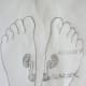 figure 12 A, kidney points in both feet