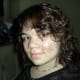 These photos are the worst that I can find. My Rosacea was actually twice as bad when I started Prosacea, I am just very camera shy during bad flares.
