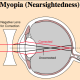how-to-handle-night-blindness-and-headlight-glare