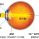 how-to-handle-night-blindness-and-headlight-glare