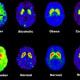 PET scans comparing addictions with normal brains.