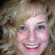 Before hair loss