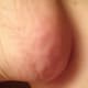 Soft, smooth skin on my heal after Baby Foot treatment.