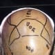 Markings done as to how many grafts goes in which part