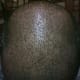 Frontal area