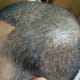 Side view, can see lots of crusts being formed